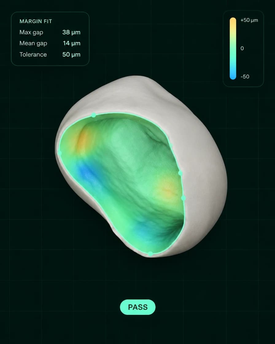 Software inspection view of a scanned crown with a color map of margin fit deviation.